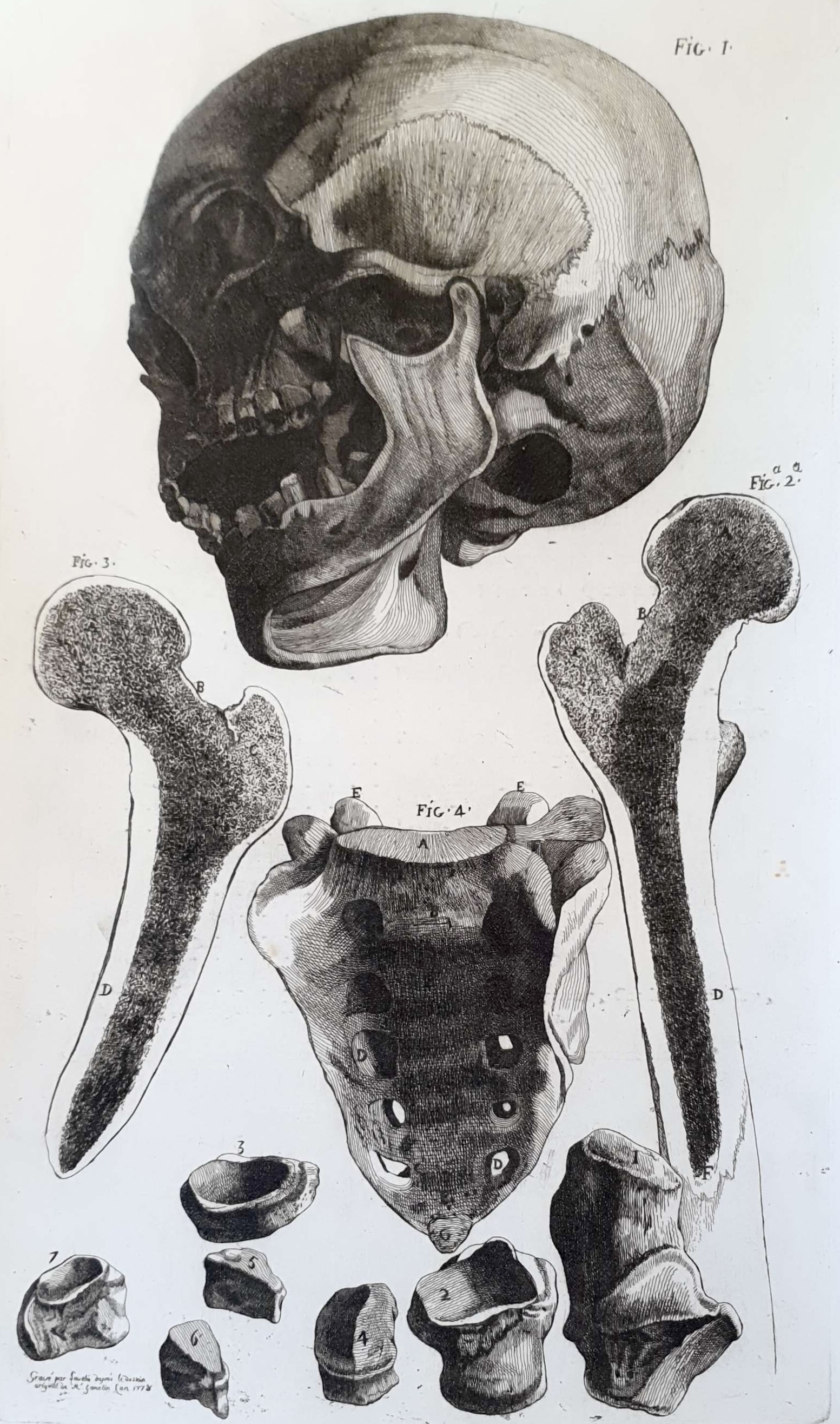 LAVALÉE Jean-Jacques